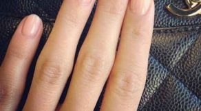 kirik-tirnak-tedavisi